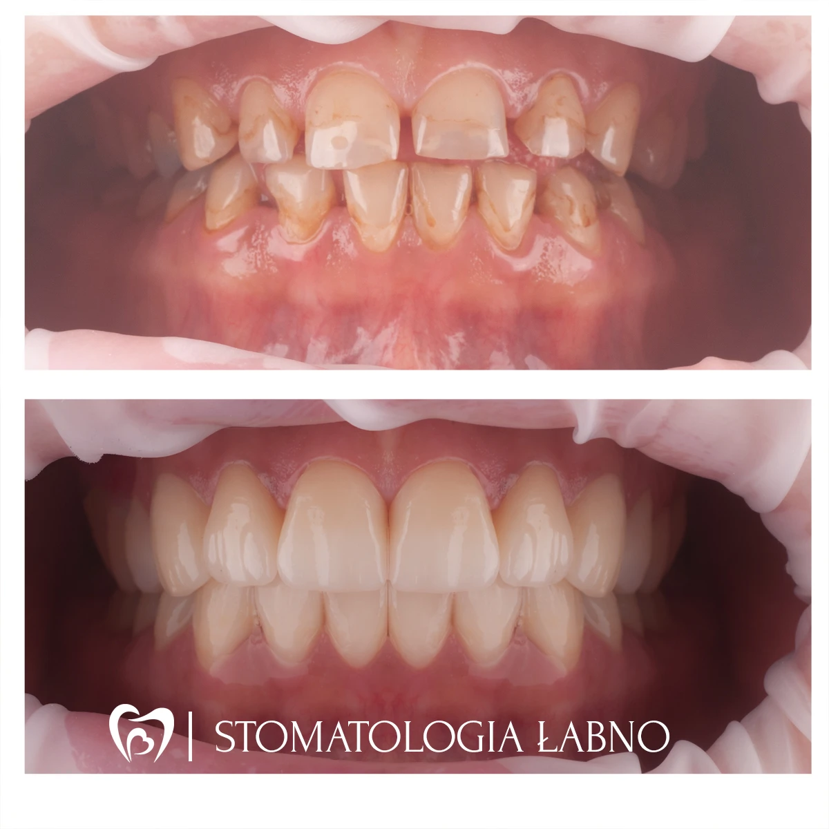 Stomatologia Łabno - aktualności